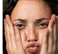 Clogged Pores & Breakouts