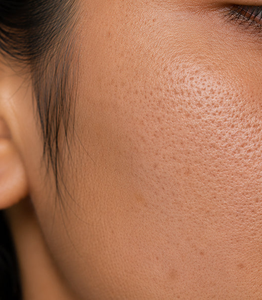 Large Pores
