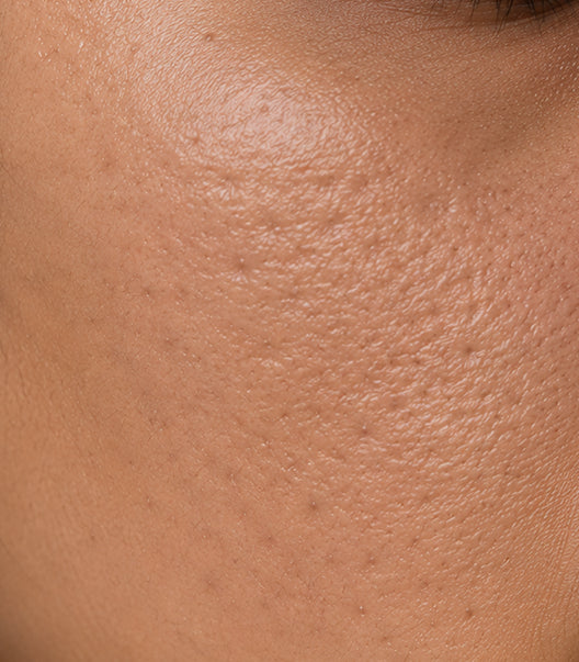 Rough Skin Texture