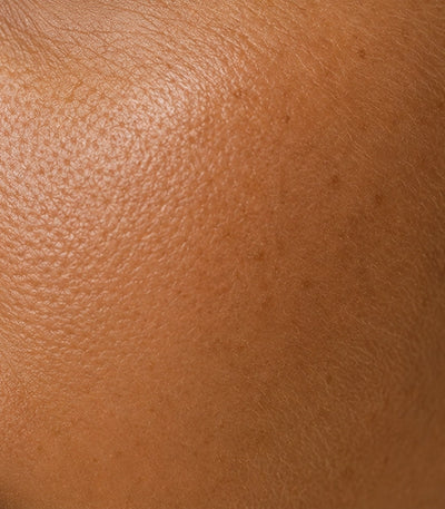 Tanned Skin Type
